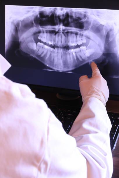 Best Dentist for Tooth Abscess  in Millers Creek, NC